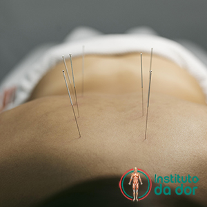 Acupuntura em casa