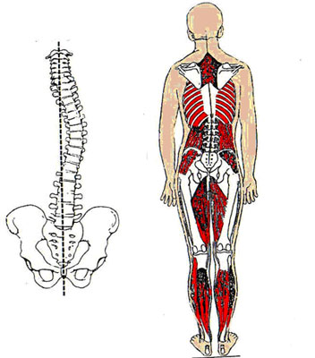 Escoliose